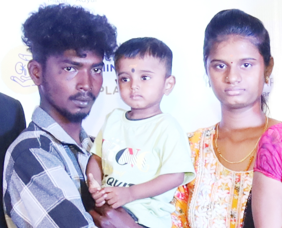 அரிய வகை நோயால் பாதிக்கப்பட்ட குழதைக்கு கல்லீரல் மாற்று அறுவை சிகிச்சை