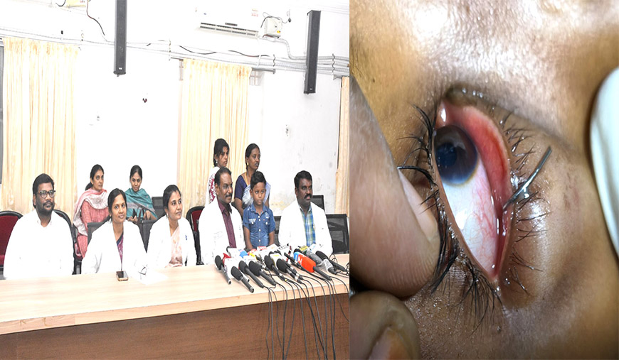 கண்ணில் பாய்ந்த ஸ்பிரிங், மூளை வரை சென்ற குச்சி மதுரை அரசு ராஜாஜி மருத்துவமனையில் இருவருக்கு மறுவாழ்வு!