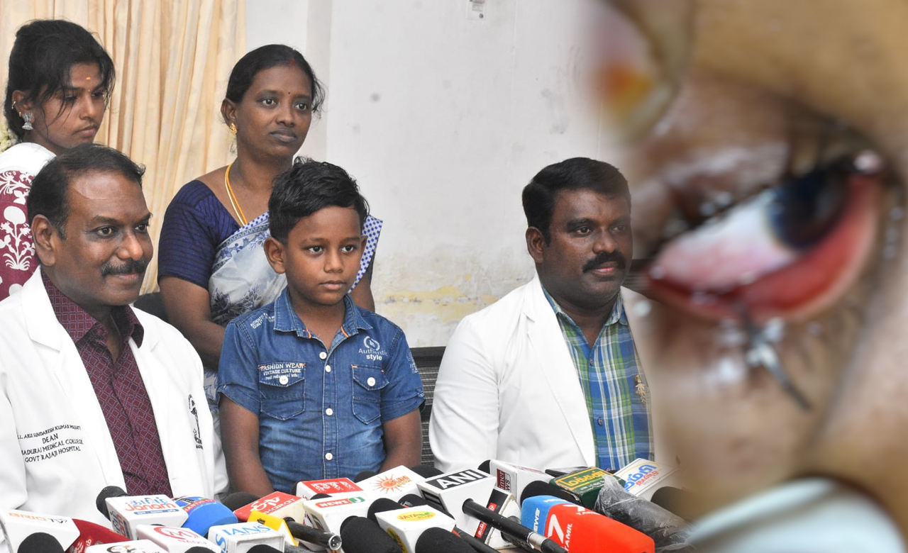 சிறுவனின் கண்ணில் சிக்கிய ஸ்பிரிங்கை அகற்றி அரசு மருத்துவர்கள் சாதனை!